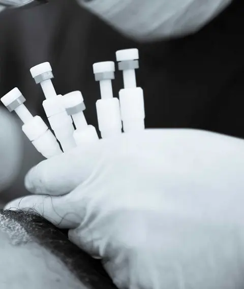 Ein DHI-Implanter-Stift setzt Grafts direkt in die Kopfhaut ein